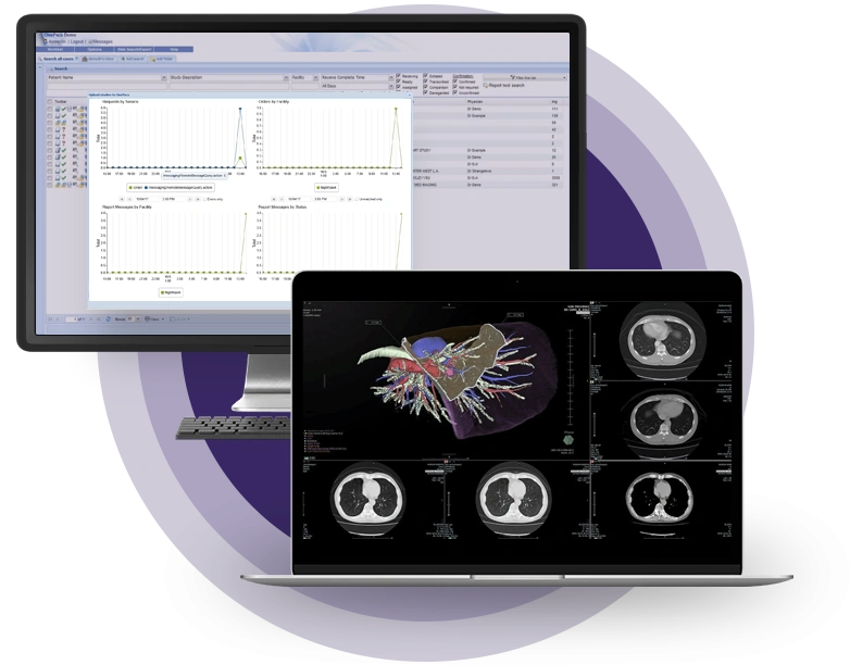 PACS Interface and Reporting