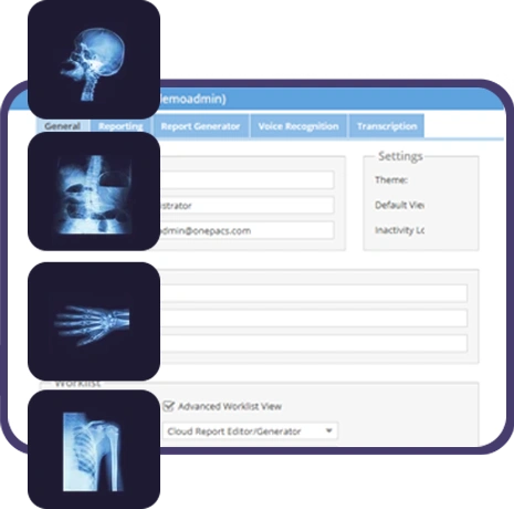 OnePACS Functionality with Xrays