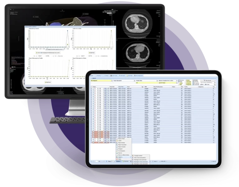OnePACS Product on Screens