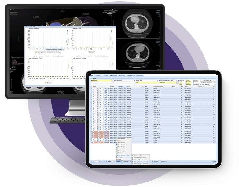 OnePACS Product on Screens