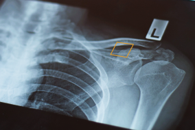 AI is Quietly Rewriting the Growth Model for Teleradiology